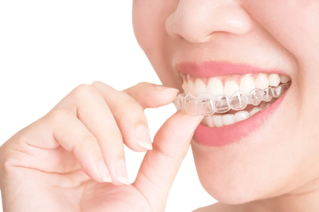 Clear invisible aligners demonstration at National Medical Center Satwa Dubai